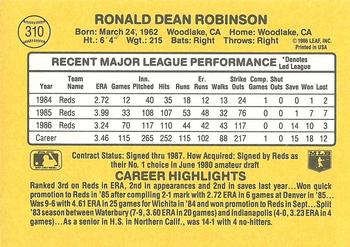 1987 Donruss #310 Ron Robinson Back