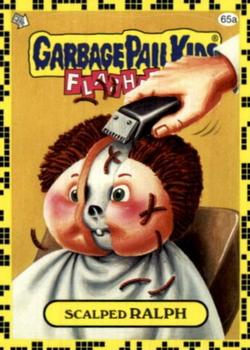 2011 Topps Garbage Pail Kids Flashback Series 2 #65a Scalped Ralph Front